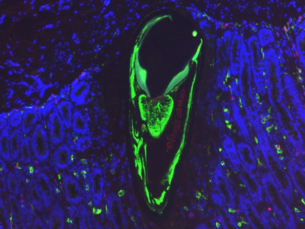 Parasites revealed using immunofluorescence and microscopy techniques