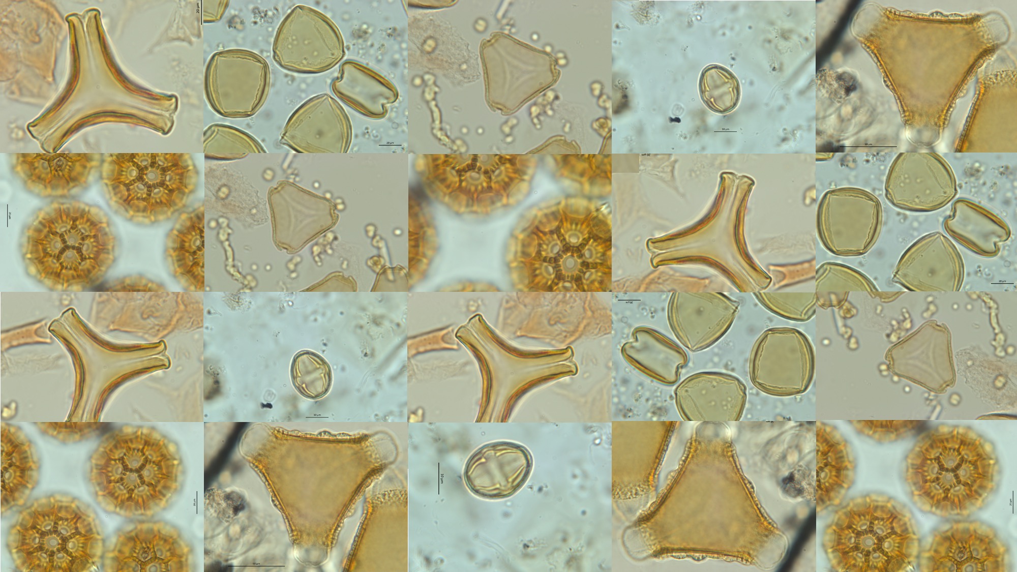 Image collage of pollen under microscope