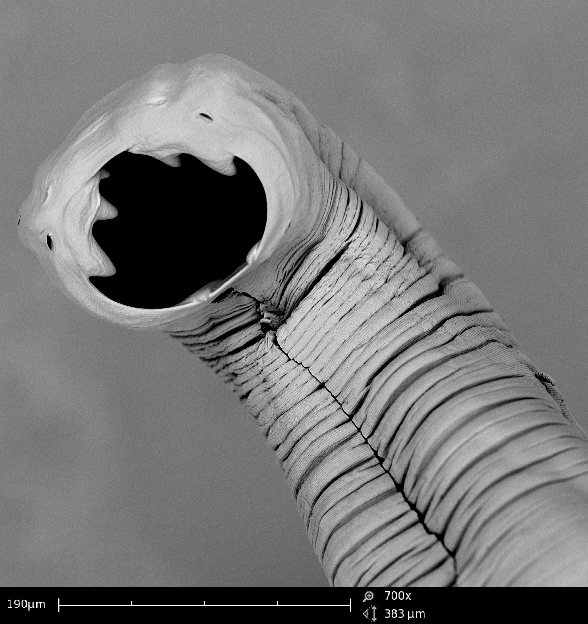 Worms fight the wheeze - Oct 2016 - JCU Australia