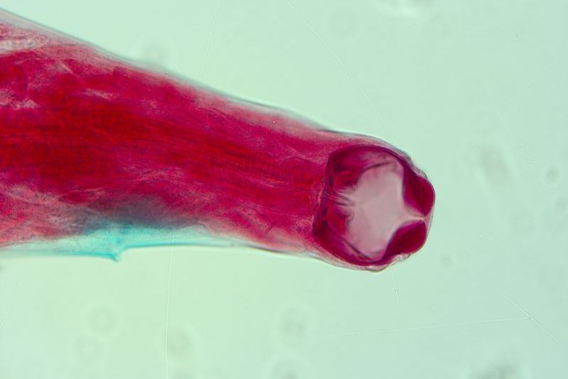 Hookworm Hookworm