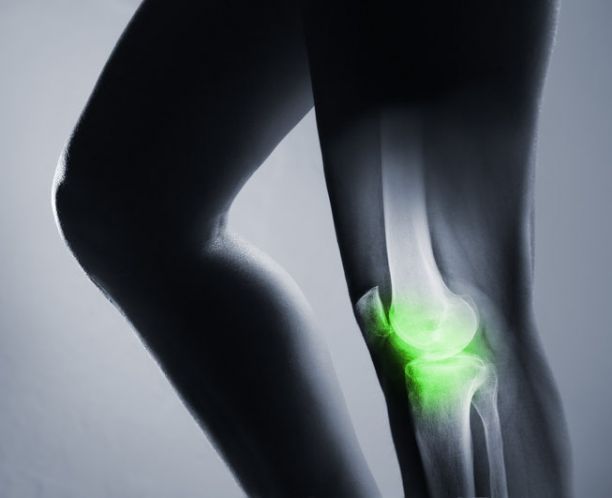 Human knee joint and leg x-ray. 
