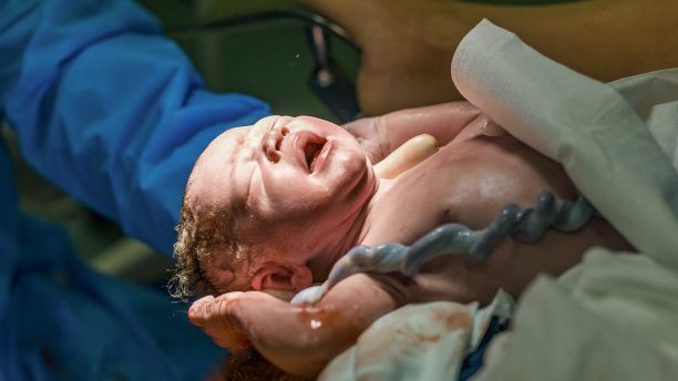 Doctor holding newborn baby with umbilical cord