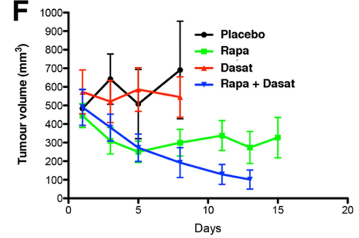 Figure 1: Combination therapy of 2 drugs studied using our novel lines for HCC showing synergistic effect in in vivo studies.