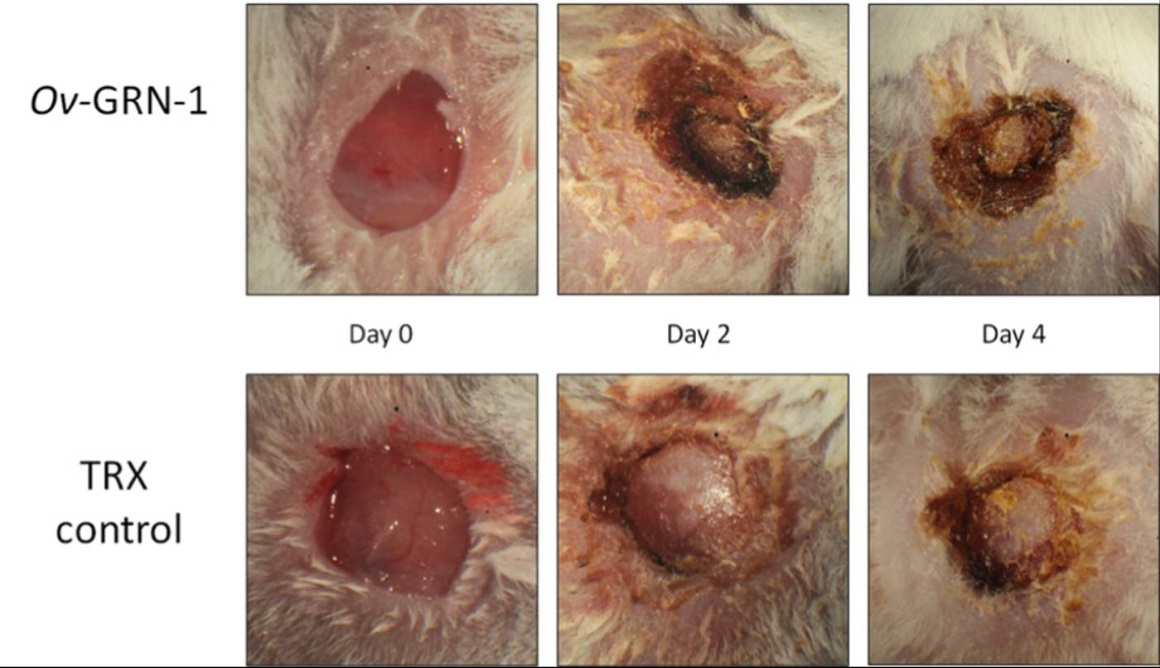 Various wounds, showcasing stages of the wound healing process.