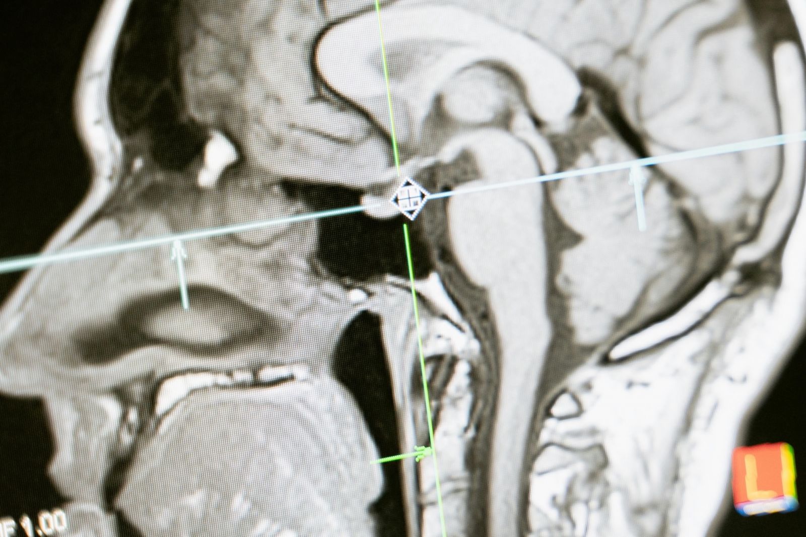 An X-ray of the head.