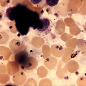 Photo of Genome-based Malaria Vaccine