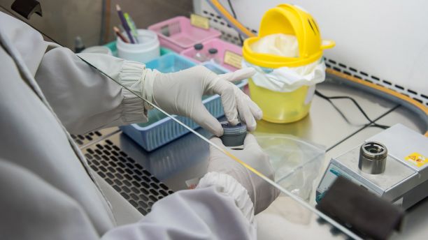 Testing a slide specimen for Mycobacterium tuberculosis testing